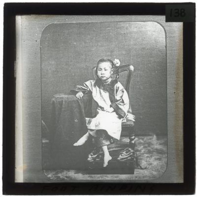 [Glass Slide.01/(138)] Foot Binding, China